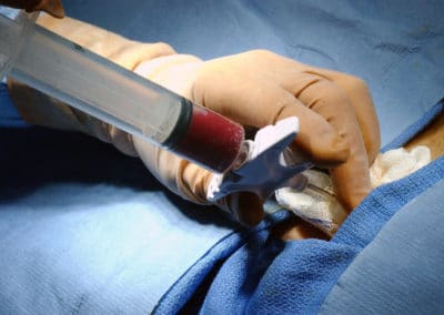 Uterus graft: A high risk ethical and medical technique