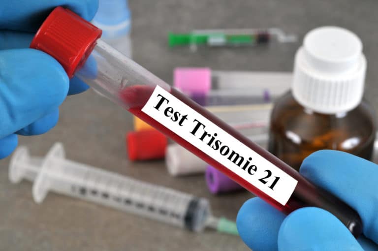 Dépistage de la trisomie 21: le Conseil d’Etat limite la diffusion du fichage national
