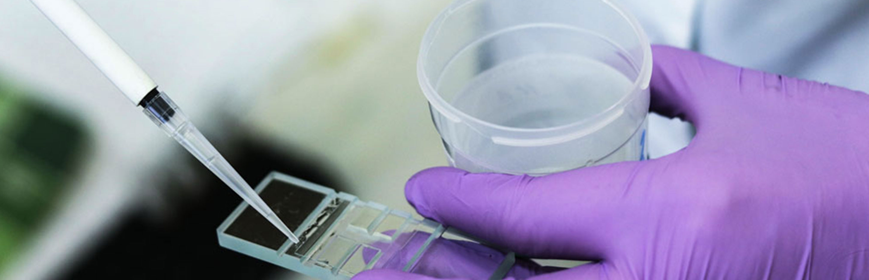 plus qu'un don de gamète, une hérédité