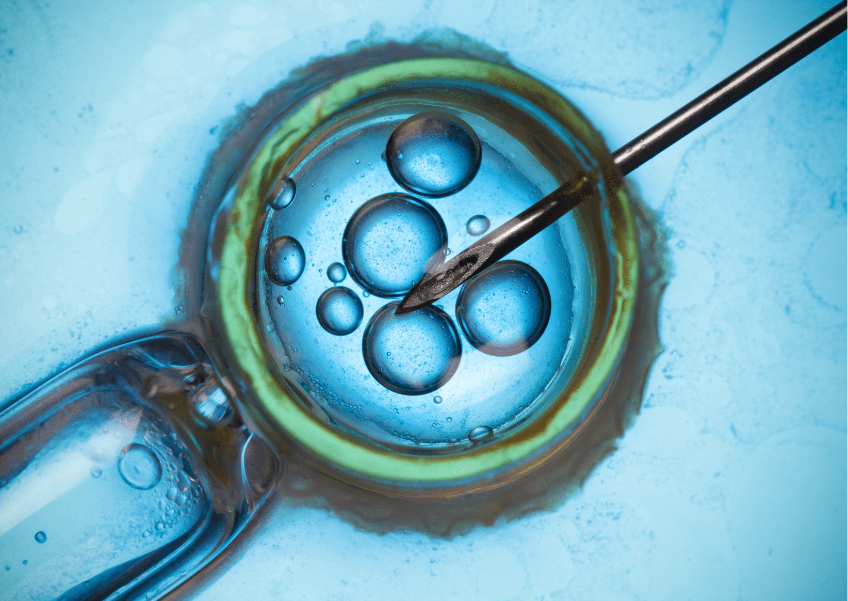 fiv pma santé procréation médicalement assistée