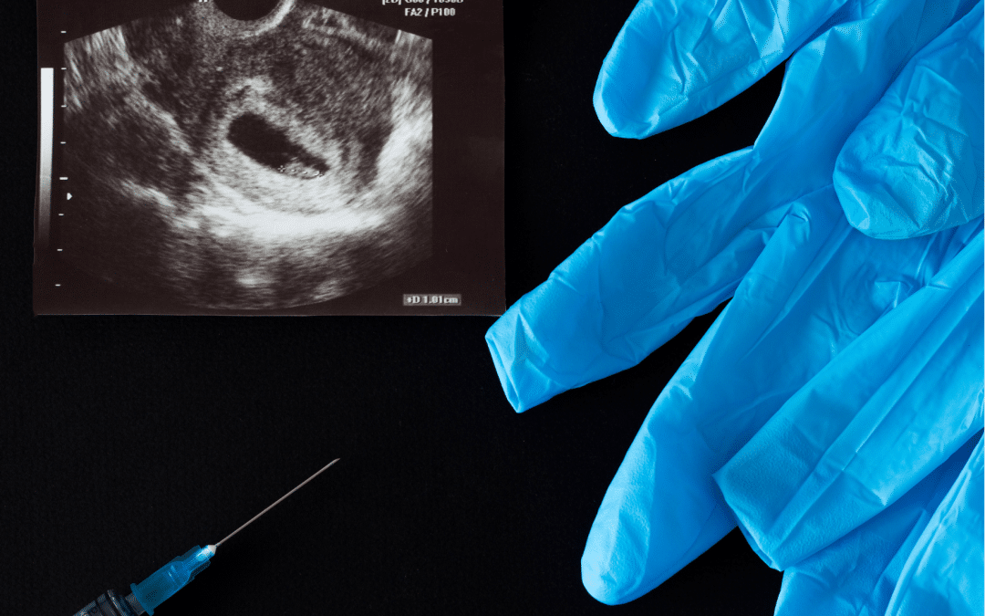 [CP] IVG : l’urgence est à la prévention pas à la constitutionnalisation