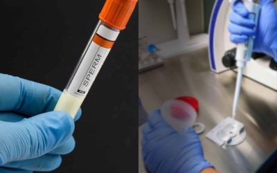 Sperm Donation, A Practice Which Involves Certain Risks