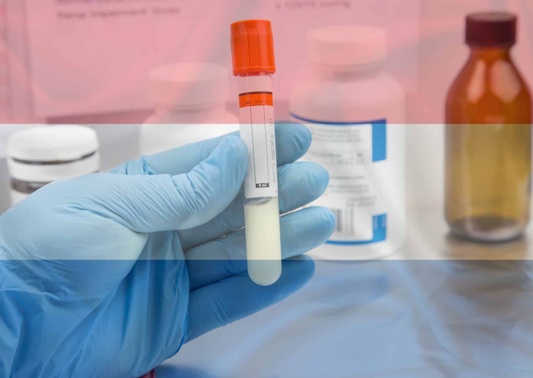 sperm donations in holland when the legal framework falls down